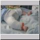 Dermot in 2nd Plaster at Hospital (2).jpg